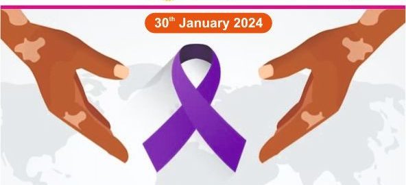 World-Leprosy-Day-1-592x270